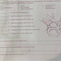 Using the key correctly identify the vertebral parts/areas described below